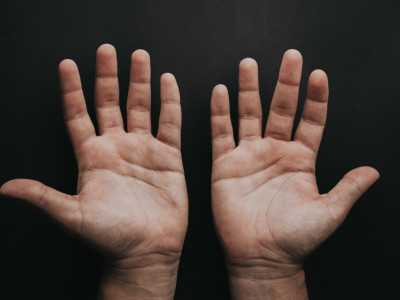 Pogledajte oba dlana i potražite TAJNI SIMBOL: Ako imate urezano slovo "X" sudbina vam je već određena!
