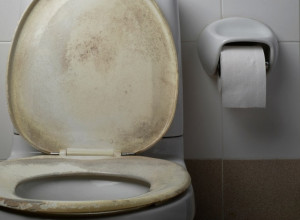 Trik koji svaka DOMAĆICA mora da zna: Kako ukloniti ŽUTE mrlje sa toaletne daske uz pomoć samo jednog proizvoda iz kuhinje