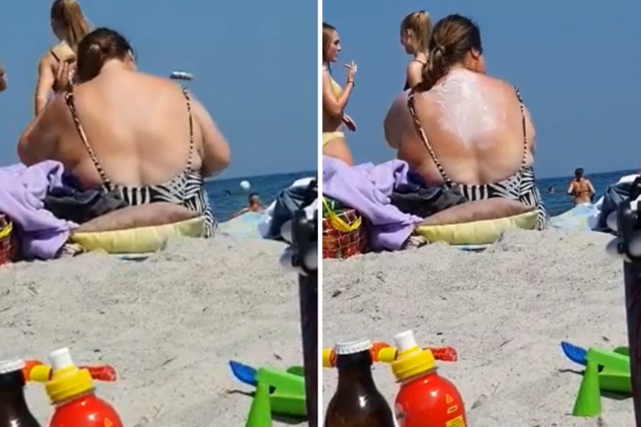 Kakva carica! Žena na plaži u Grčkoj smislila genijalan način kako da sama sebi namaže leđa i sada joj svi moleri zavide (VIDEO)