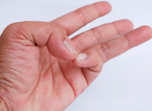 Probajte trik sa palčevima: Za 3 sekunde otkrijte da li vam je zdravlje ugroženo
