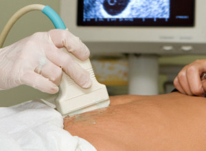 Na ultrazvuku doživeo noćnu moru: "Datum začeća bebe nije se poklapao sa našom vezom"