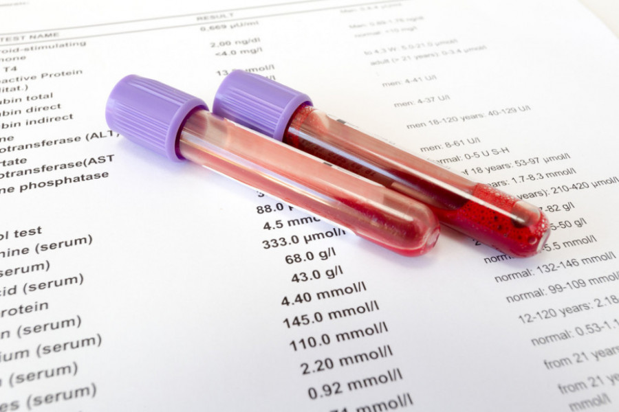 Vaša krvna slika nije u redu ukoliko pokazuje ovo: Doktor otkrio kako se čita nalaz biohemije