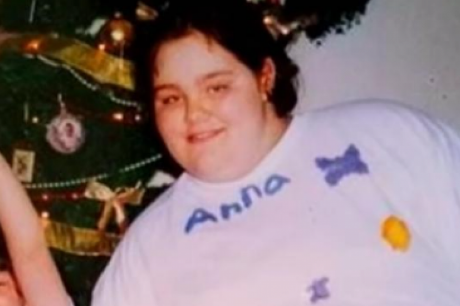 Ana je izgubila 152 kilograma: Htela je da deca budu ponosna na nju, a sada svoje telo mrzi još više