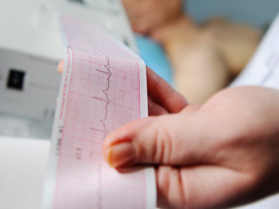 Doktor otkrio znakove koji najavljuju da staje srce: Javljaju se 24 sata pre napada