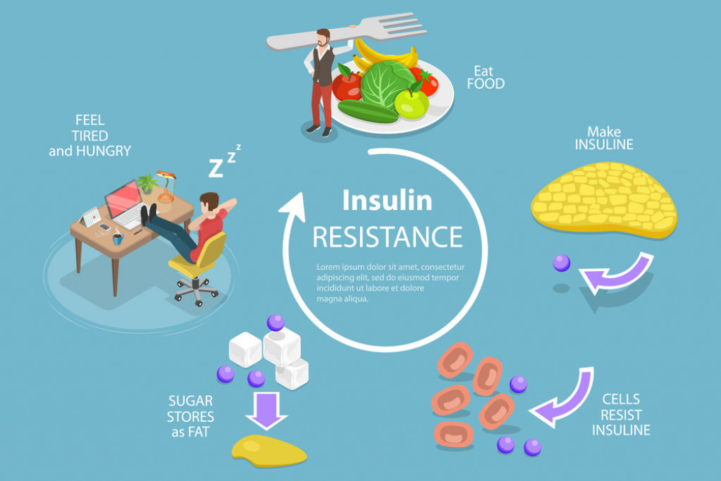 Insulinska rezistencija je 