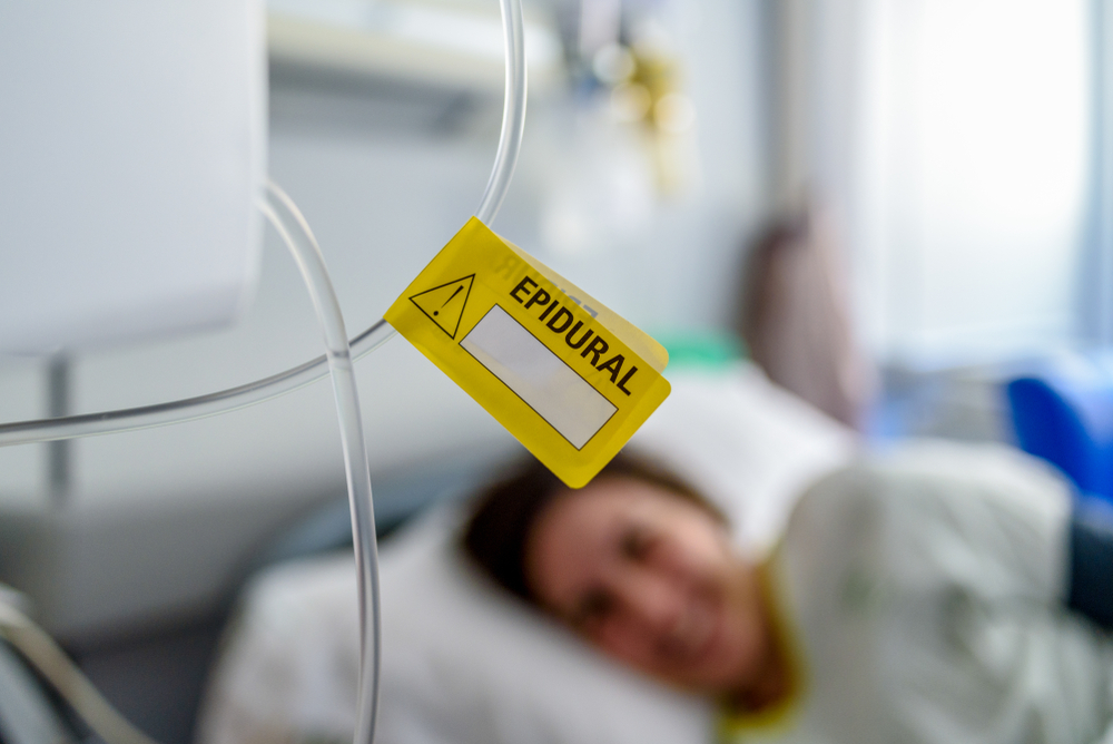 Epidural Epidural