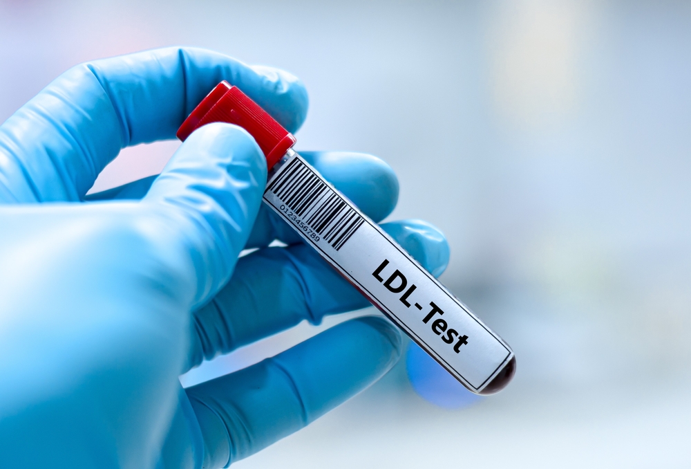 LDL