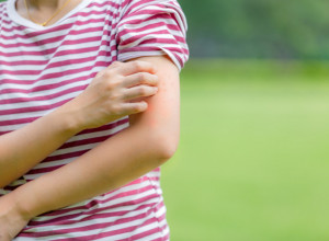 Nedostatak vitamina D se može videti na koži: Obratite pažnju na ove neobične simptome!