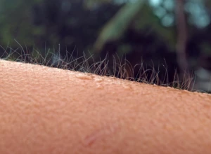 Zašto se JEŽIMO?  Telo nam ovako govori JEDNU BITNU STVAR