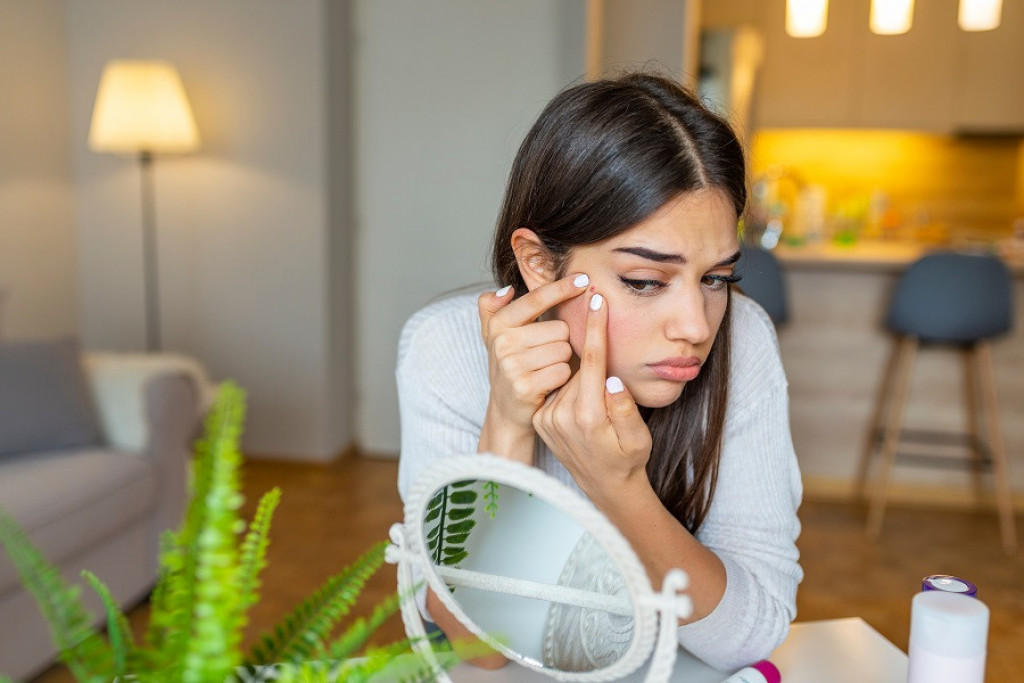Kako pravilno ISTISNUTI BUBULJICU? Dermatolog vas moli da se pridržavate ovih pravila