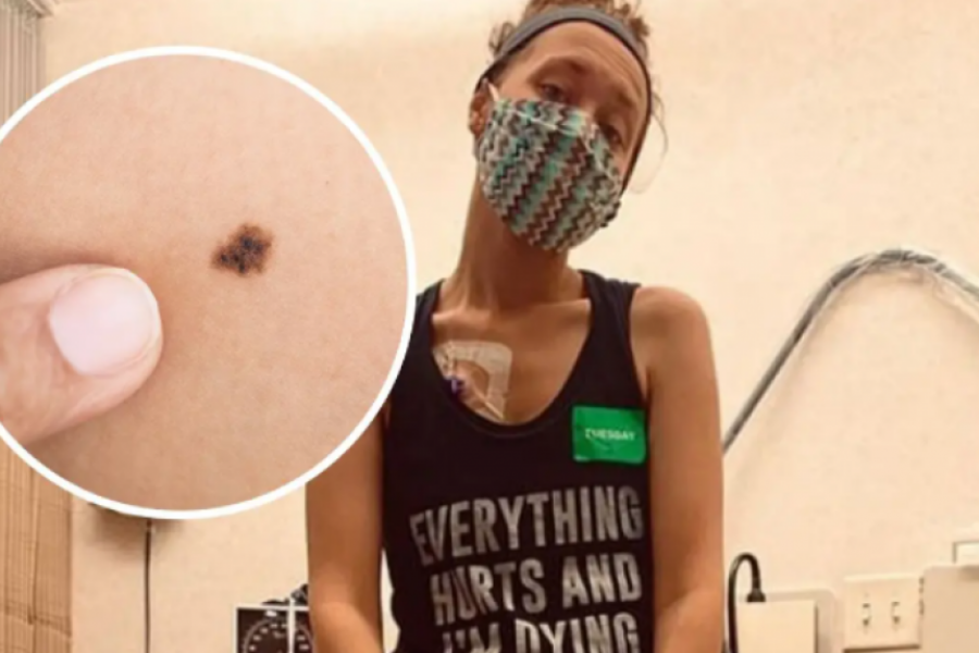 "Idite na pregled jednom godišnje": Ova mlada žena nije obraćala pažnju na ovaj MLADEŽ i sada umire od raka