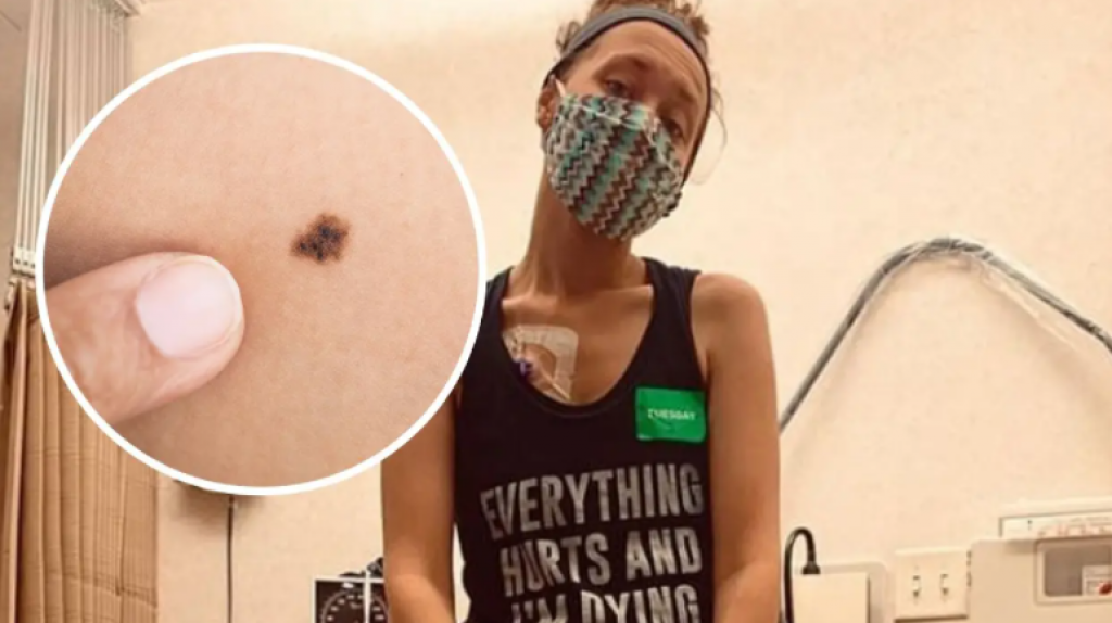 "Idite na pregled jednom godišnje": Ova mlada žena nije obraćala pažnju na ovaj MLADEŽ i sada umire od raka