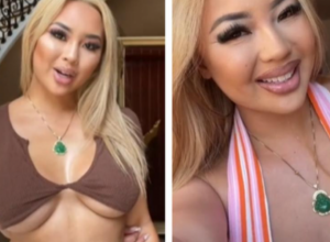 Ne može da SEDI, ni da ide u TOALET: Posle estetskog zahvata ona ima VELIKIH problema, ali zahvaljujući tome zarađuje MILIONE