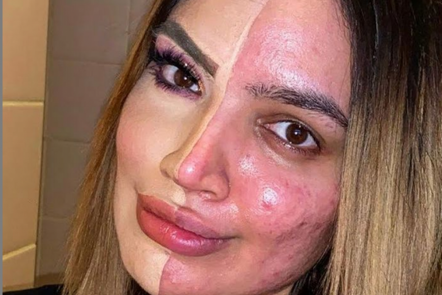 "Zvali su me HODAJUĆA BOLEST": Kada je infuenserka prestala da koristi FILTERE i pokazala svoje lice, ljudi su reagovali veoma BURNO