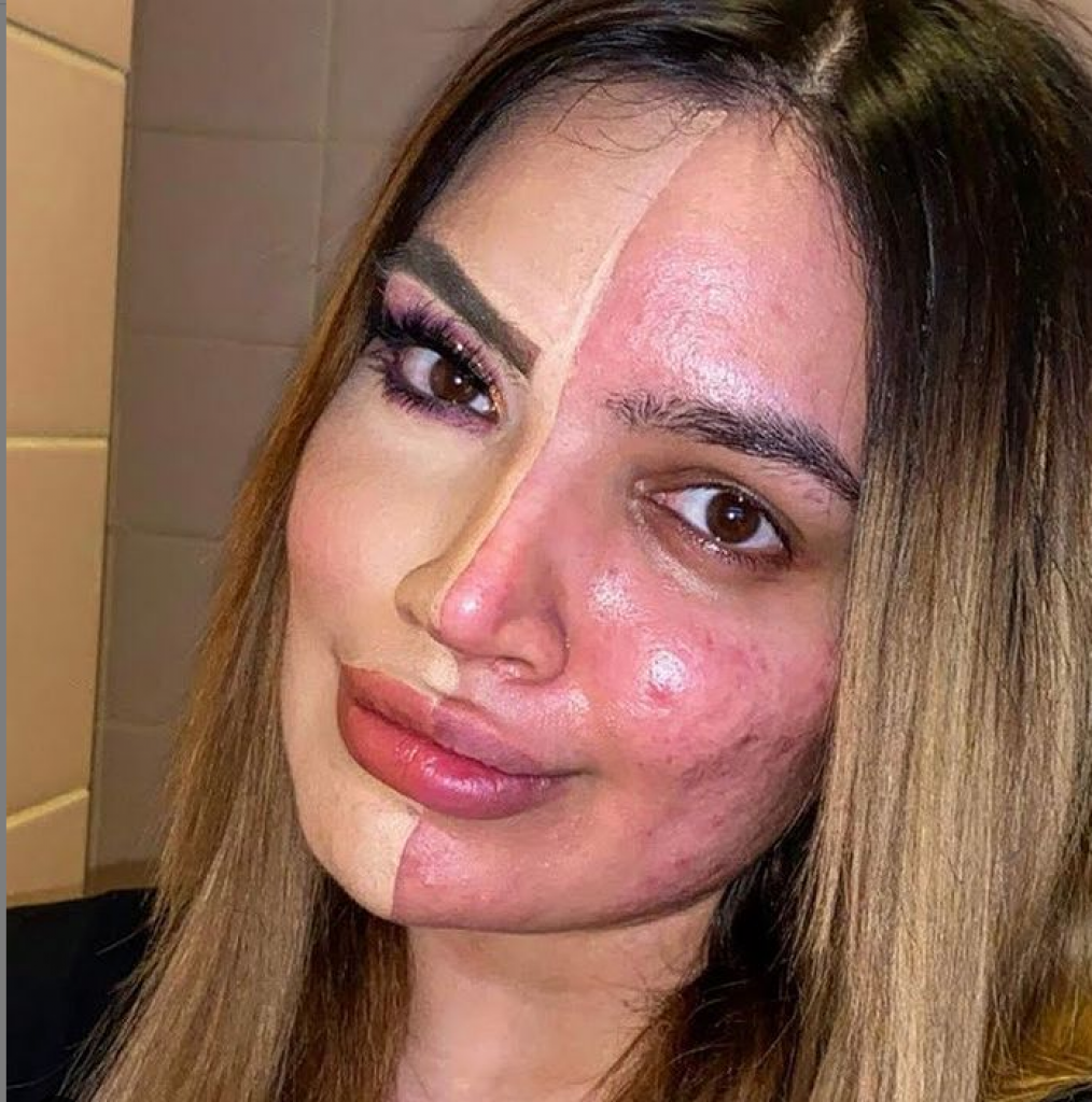 "Zvali su me HODAJUĆA BOLEST": Kada je infuenserka prestala da koristi FILTERE i pokazala svoje lice, ljudi su reagovali veoma BURNO