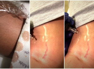 Tatjanin životni "poziv" je pravi SPAS za neke: Ova umetnica TETOVIRA ljude na NEOBIČAN način i tako skriva ožiljke i STRIJE