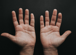 Dobro pogledajte u dlan: Ako na koži primetite ovo, gvožđe vam je kritično nisko i preti vam anemija