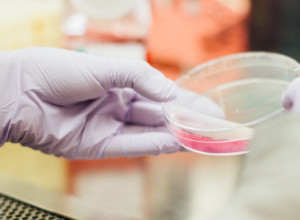 Možete da ga kupite u SVIM apotekama, njegova cena je pristupačna: Pojačava efekat VAKCINE i čuva IMUNITET