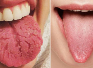 Uzmite ogledalo i isplazite JEZIK: Dobro pogledajte da li imate ove PROMENE, to je znak da se dešava proces koji vam se NEĆE DOPASTI