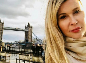 Samo JEDAN zahvat na licu uništio je ZAUVEK: Svetlana (37) dobila je izgled iz najgorih košmara, zbog ovoga se gorko kaje!