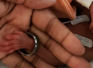 PALČICA: Bila je manja od BARBIKE, i teška kao jedna jabuka, posle 150 dana konačno ide KUĆI