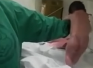 Babice su ostale u ČUDU: Novorođenče PROHODALO samo par minuta nakon rođenja!