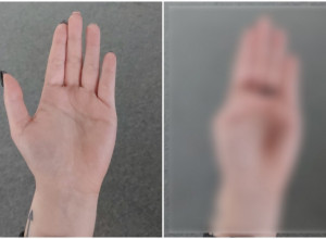 Isprobajte brzi test sa PALCEM: Ako možete da uradite ovo, HITNO idete kod lekara!