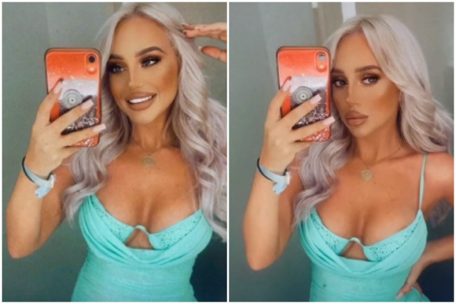 Došla je u Evropu da sredi ZUBE, a kada se vratila kući desilo se nešto NEOČEKIVANO: Lice joj je UNAKAŽENO i ne zna da li će se oporaviti!