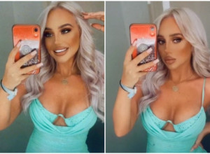 Došla je u Evropu da sredi ZUBE, a kada se vratila kući desilo se nešto NEOČEKIVANO: Lice joj je UNAKAŽENO i ne zna da li će se oporaviti!