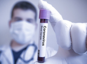 Žena se za tri nedelje dva puta inficirala KORONOM: NAUČNICI se pitaju KAKO je ovo moguće!