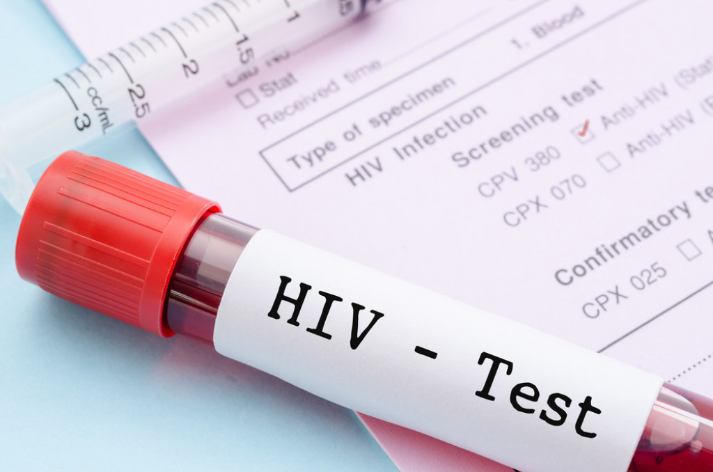 "Moja porodica još uvek ne zna da sam HIV POZITIVAN": Dečko (29) podelio je svoju priču i trenutak kada je shvatio da ima NEIZLEČIVU BOLEST!