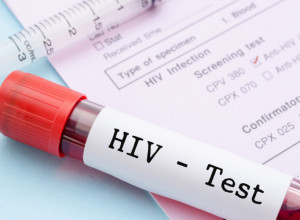 "Moja porodica još uvek ne zna da sam HIV POZITIVAN": Dečko (29) podelio je svoju priču i trenutak kada je shvatio da ima NEIZLEČIVU BOLEST!
