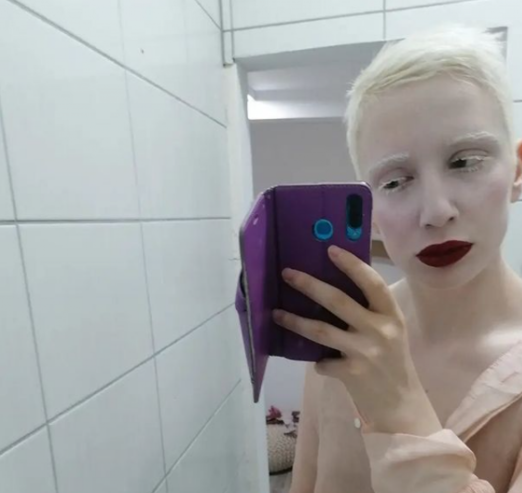 Rođena je DRUGAČIJA i zbog toga su je MALTRETIRALI godinama: Svetlana iz Obrenovca sa 15 godina dobila je DIJAGNOZU koja joj je ZAUVEK promenila život!