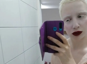 Rođena je DRUGAČIJA i zbog toga su je MALTRETIRALI godinama: Svetlana iz Obrenovca sa 15 godina dobila je DIJAGNOZU koja joj je ZAUVEK promenila život!