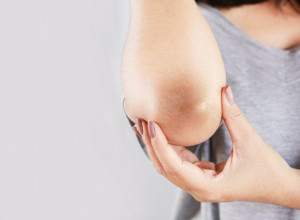 Dobro pogledajte svoje laktove: Promene na njima ukazuju na ozbiljnu bolest