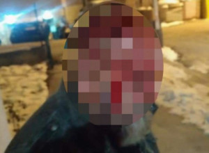 TANDEM PRETUKAO ISADA MURATOVIĆA: Policija rasvetlila prebijanje člana Opštinskog odbora Demokrata u Petnjici