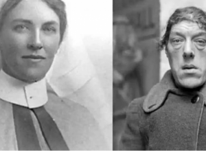 Postala je "najružnija žena na svetu" preko NOĆI: Zbog svog izgleda je IZGUBILA POSAO, a malo ljudi je znalo da je ozbiljno bolesna