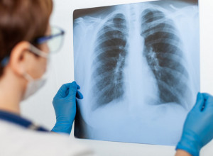 Očistite PLUĆA od TOKSINA na prirodan način: Ovi SOKOVI su pravo BLAGO za organizam i ZDRAVLJE