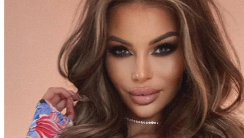 Popularna INFLUENSERKA pokazala fotografije iz mlađih dana: Ovako je izgledala pre PLASTIČNIH operacija, ne liči na SEBE!