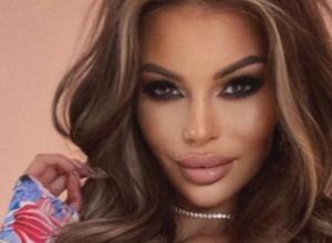 Popularna INFLUENSERKA pokazala fotografije iz mlađih dana: Ovako je izgledala pre PLASTIČNIH operacija, ne liči na SEBE!