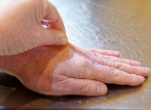 Uradite ovaj jednostavan TEST i proverite da li vam je TELO dovoljno HIDRIRANO