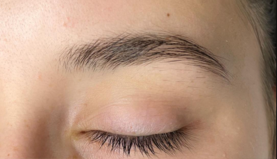 Izgled obrva otkriva bolest: Ako primetite da su se proredile, odmah kod lekara