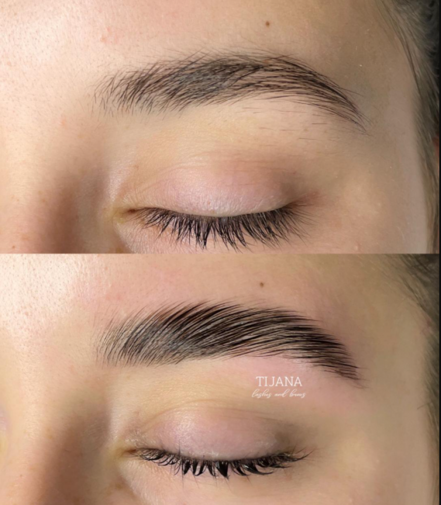 Izgled obrva otkriva bolest: Ako primetite da su se proredile, odmah kod lekara