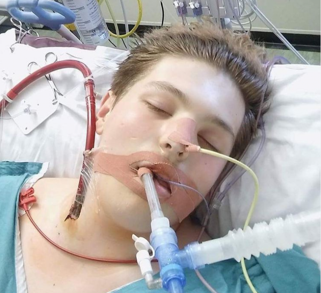 Ivan je sa 16 godina već bio PUŠAČ:  Otkazali su mu ORGANI i završio  je sa plućima OSAMDESTOGODIŠNJAKA, i to samo zato što je birao "ZDRAVIJU" varijantu!