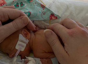 Osećala je da nešto nije u redu sa BEBOM: Trudnica je zamolila DOKTORE da je pregledaju a onda je otkrila nešto što ih je sve UPLAŠILO!