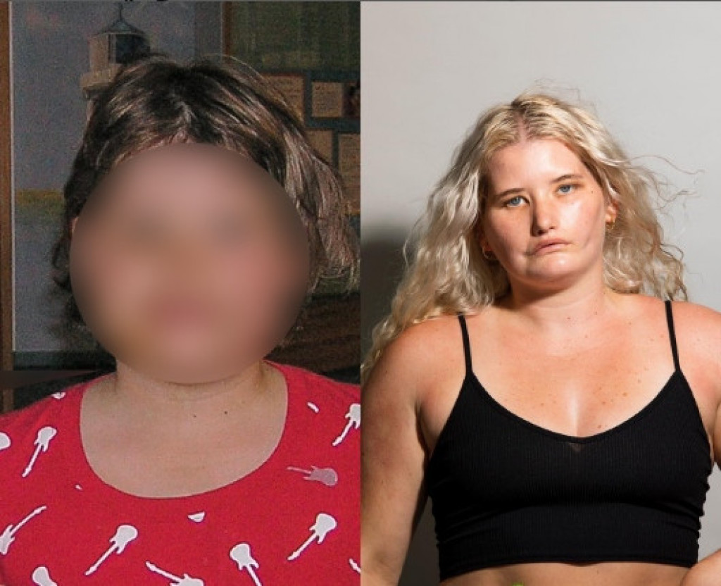 "Deca u ŠKOLI su mi nabijala KESU na glavu": Tajla pati od RETKOG poremećaja, detinjstvo joj je bilo prava TRAUMA, a danas inspiriše mnoge mlade ljude