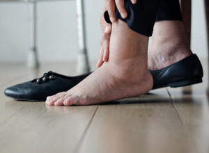 Da li vam OTIČU noge? Stari narodni NAPITAK pomaže MOMENTALNO, od ovoga ne postoji ništa bolje!