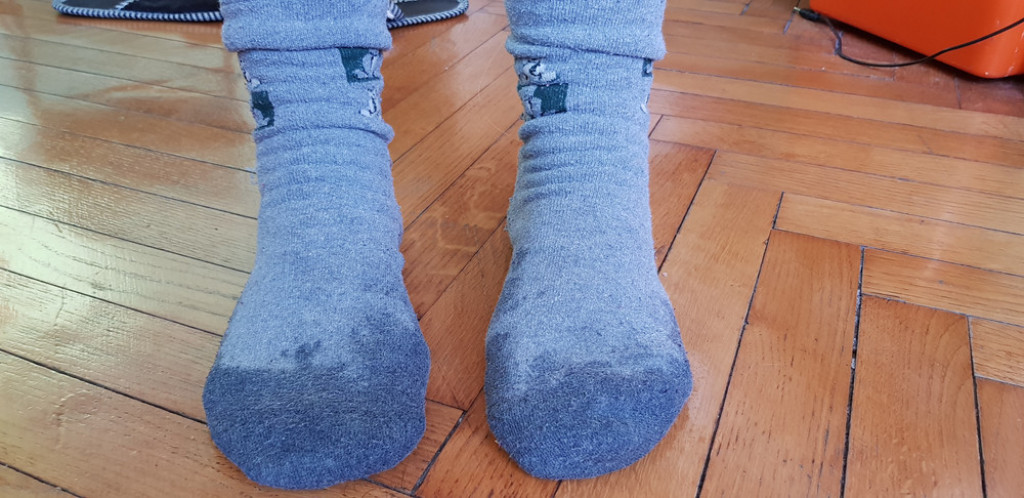 ZASPALA JE SA MOKRIM ČARAPAMA NA NOGAMA: Ujutru je sačekalo nešto NEOBIČNO, nije mogla da poveruje