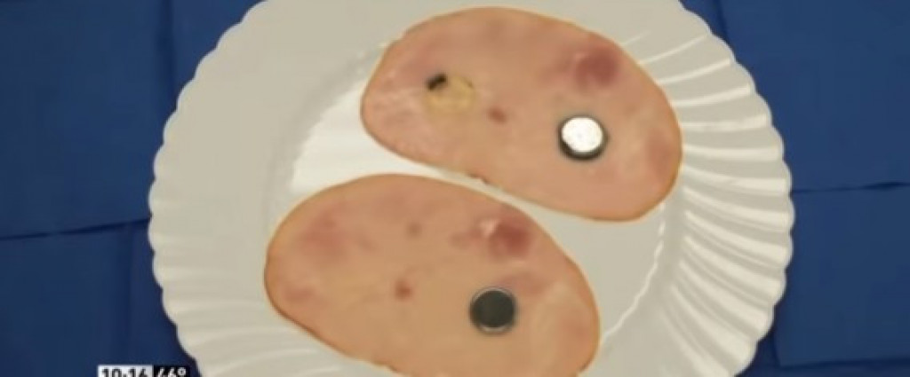 Šta raditi kada dete proguta BATERIJU? Posle ovog VIDEA sklanjaćete od dece tehničke stvarčice