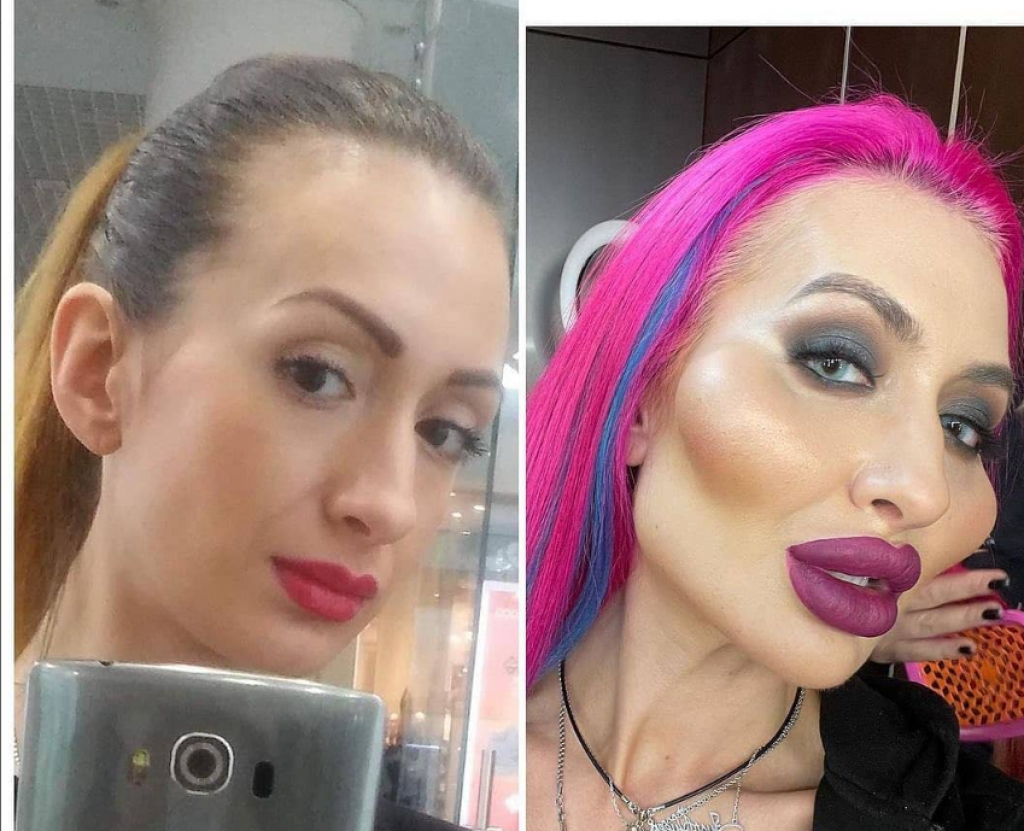 Šta se desilo ANASTASIJI? Ona ima najveće OBRAZE na svetu i misli da izgleda PROPORCIONALNO, a zgrozićete se kad čujete kako je postigla ovakav IZGLED!